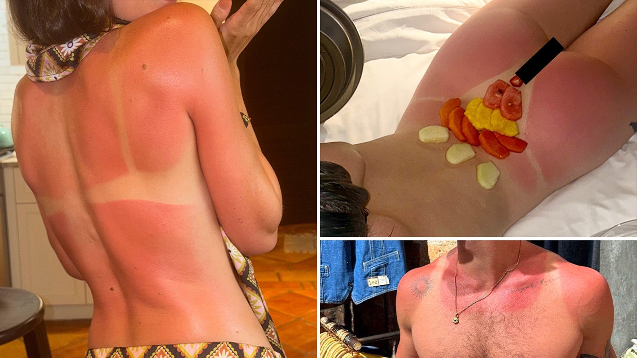 TMZ Turns Celebrity Sunburns Into a Guessing Game