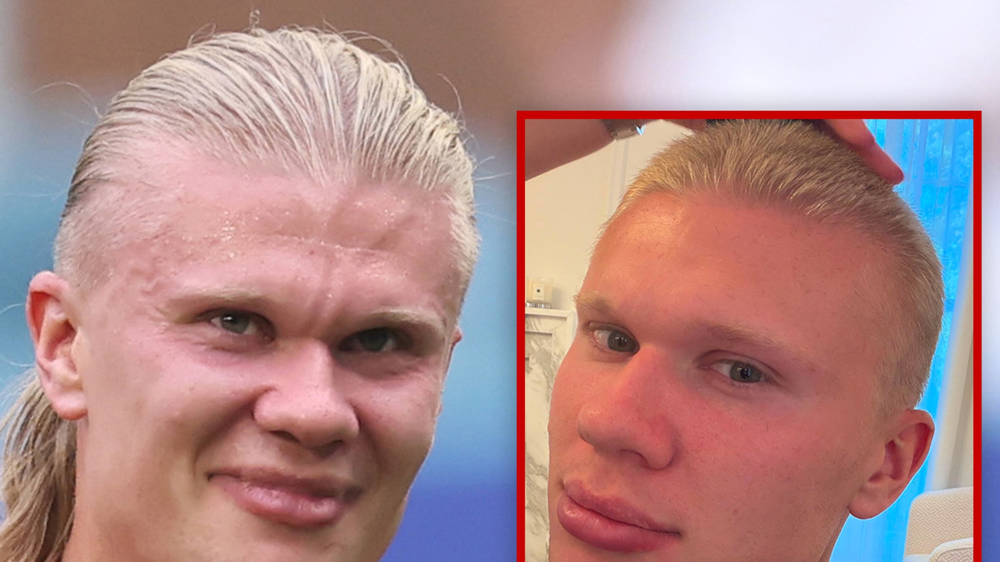 Erling Haaland Trades His Signature Hair for a Buzz Cut